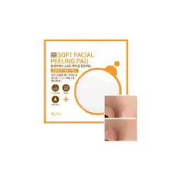 پد لایه برداری صورت Mjcare - پد لایه برداری Yüz