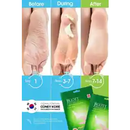 ماسک لایه بردار پا از نوع جوراب جیگوت - پک لایه برداری پا معجزه آسا