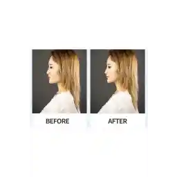 LastingBeauty Face Lift Eebrow Lift Buckle Botox Effective Magic Buckle Slanting Ebrow